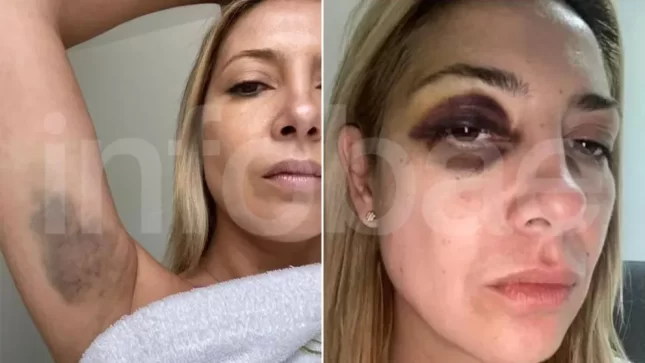 Fabiola Yañez a Alberto Fernández: “Venís golpeándome hace tres días seguidos”