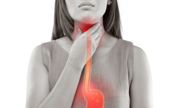 Salud. Reflujo Gastroesofágico: una patología frecuente con repercusiones en otros órganos